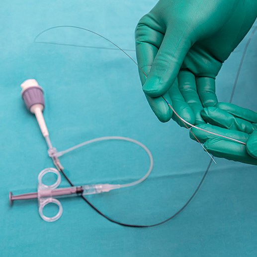 Hands in medical gloves holding a purge catheter in hands.