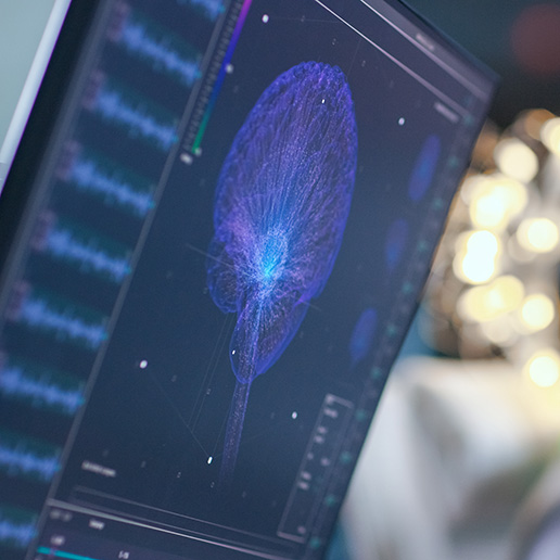 Monitors showing an EEG reading and graphical brain model