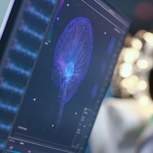 laser wire ablation systems for medical sensors - brain monitor data screen